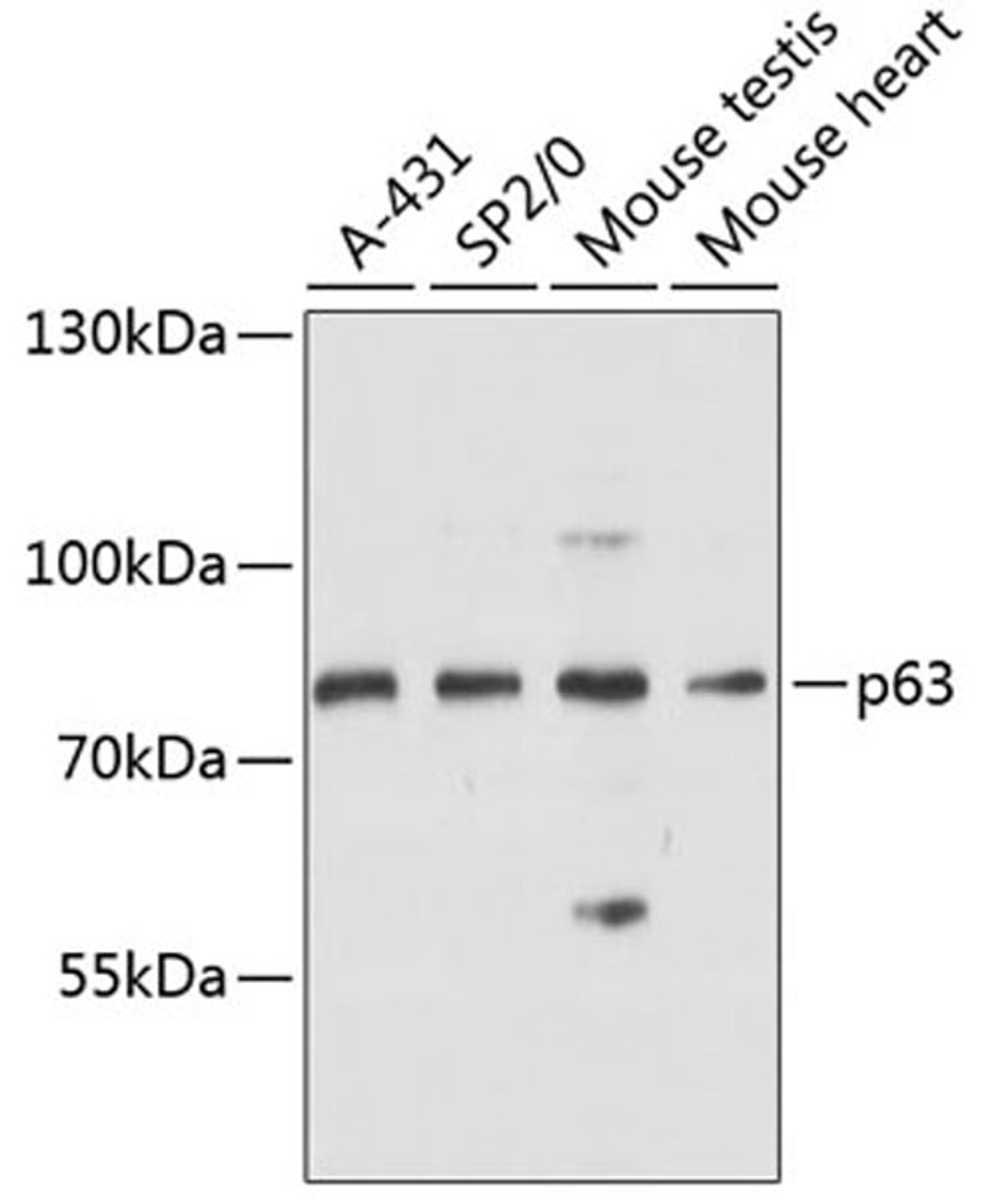 Western blot - p63 antibody (A12937)