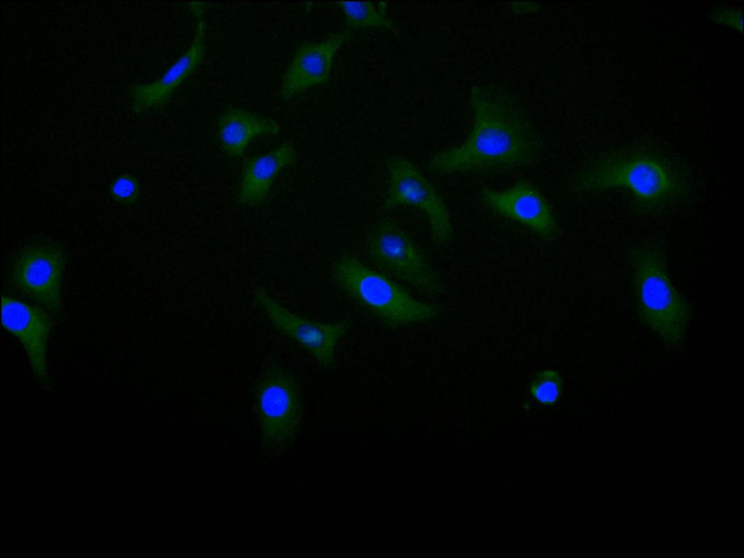 Immunofluorescence staining of Hela cell with CSB-RA005036MA1HU at 1:10, counter-stained with DAPI. The cells were fixed in 4% formaldehyde and blocked in 10% normal Goat Serum. The cells were then incubated with the antibody overnight at 4C. The secondary antibody was FITC-conjugated AffiniPure Goat Anti-Human IgG(H+L).