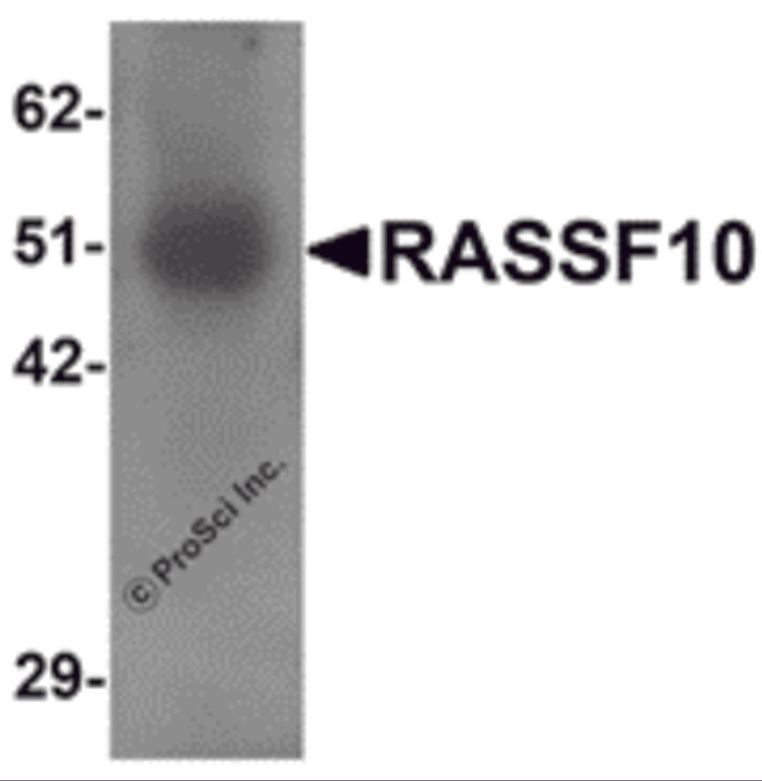 Western blot analysis of RASSF10 in human lung tissue lysate with RASSF10 antibody at 1 &#956;g/mL