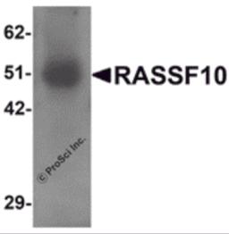 Western blot analysis of RASSF10 in human lung tissue lysate with RASSF10 antibody at 1 &#956;g/mL