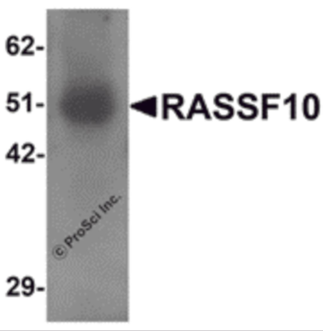 Western blot analysis of RASSF10 in human lung tissue lysate with RASSF10 antibody at 1 μg/mL