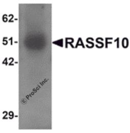 Western blot analysis of RASSF10 in human lung tissue lysate with RASSF10 antibody at 1 μg/mL