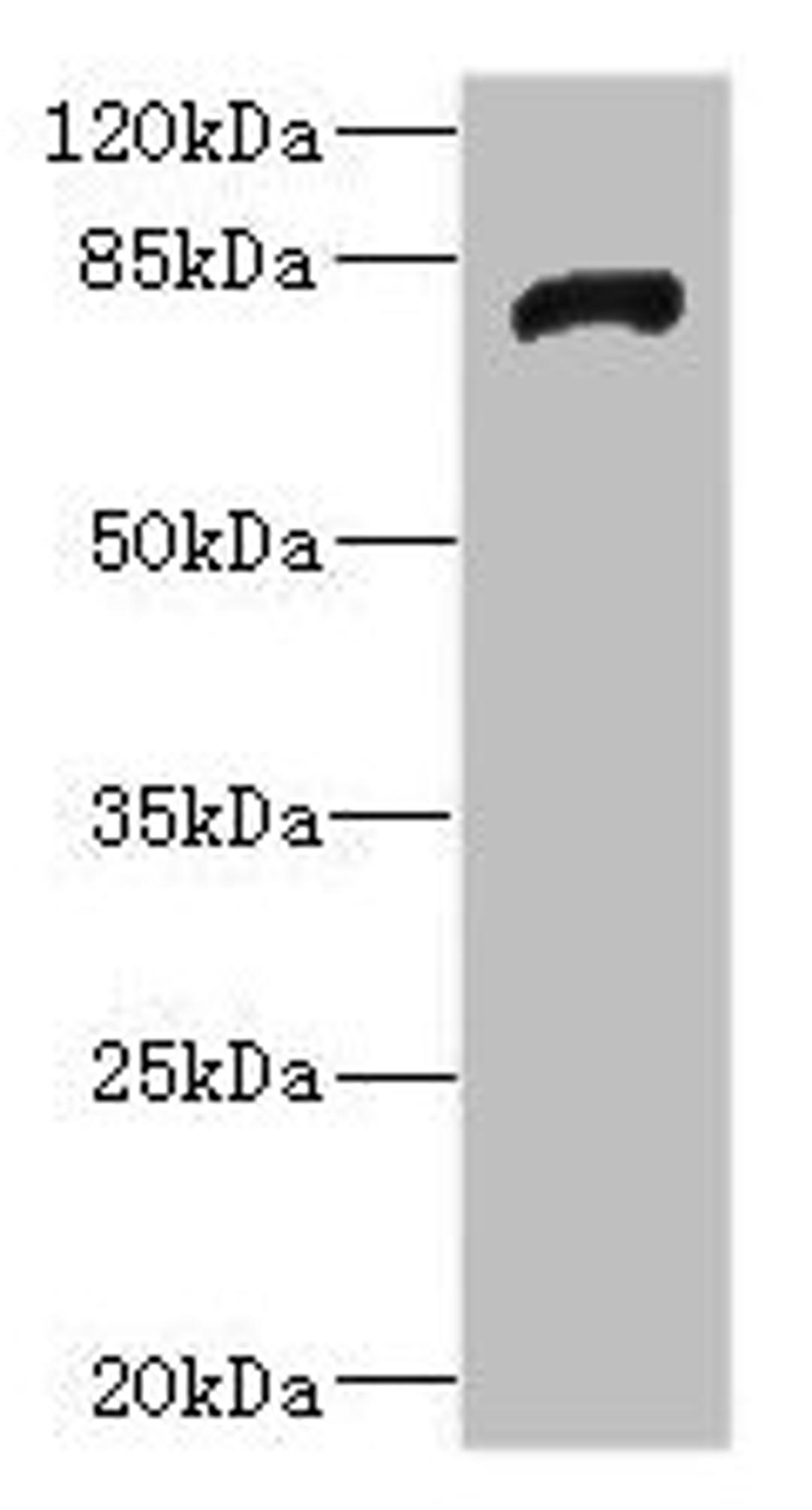 Western blot. All lanes: HHIPantibody IgG at 1.92ug/ml + Rat heart tissue. Secondary. Goat polyclonal to rabbit IgG at 1/10000 dilution. Predicted band size: 79, 37 kDa. Observed band size: 79 kDa. 