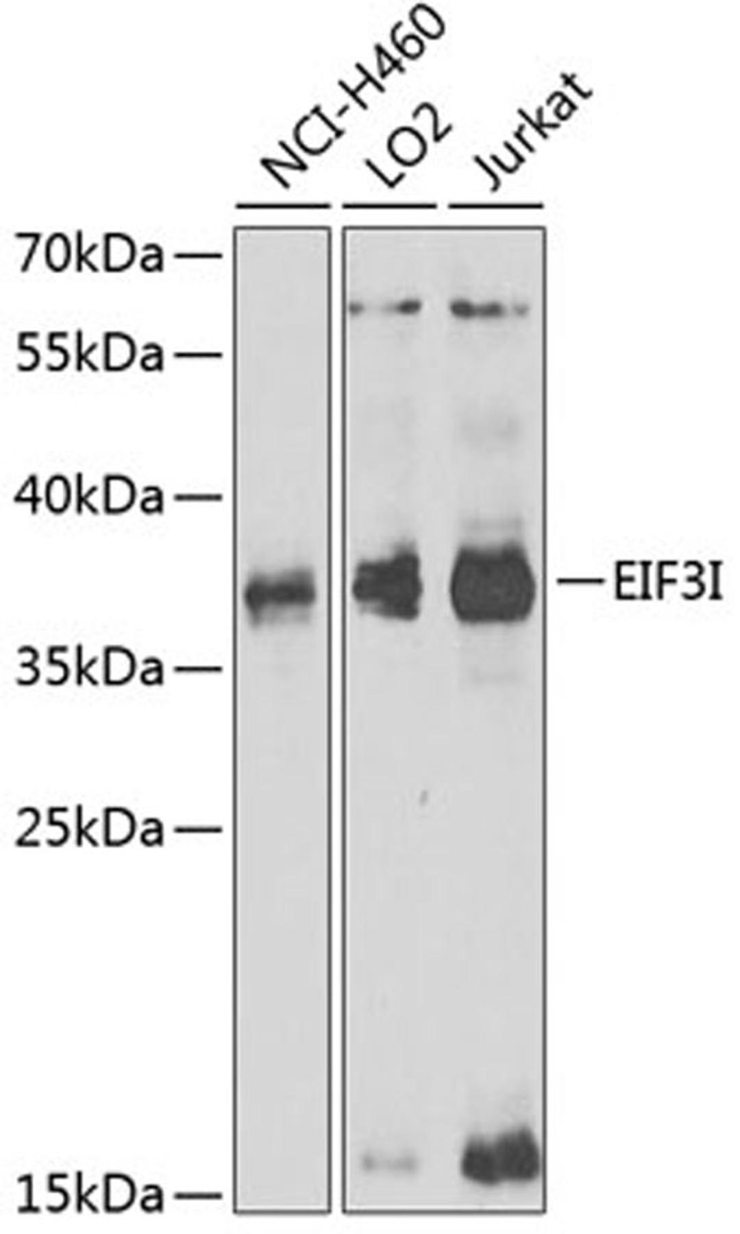 Western blot - EIF3I antibody (A6582)