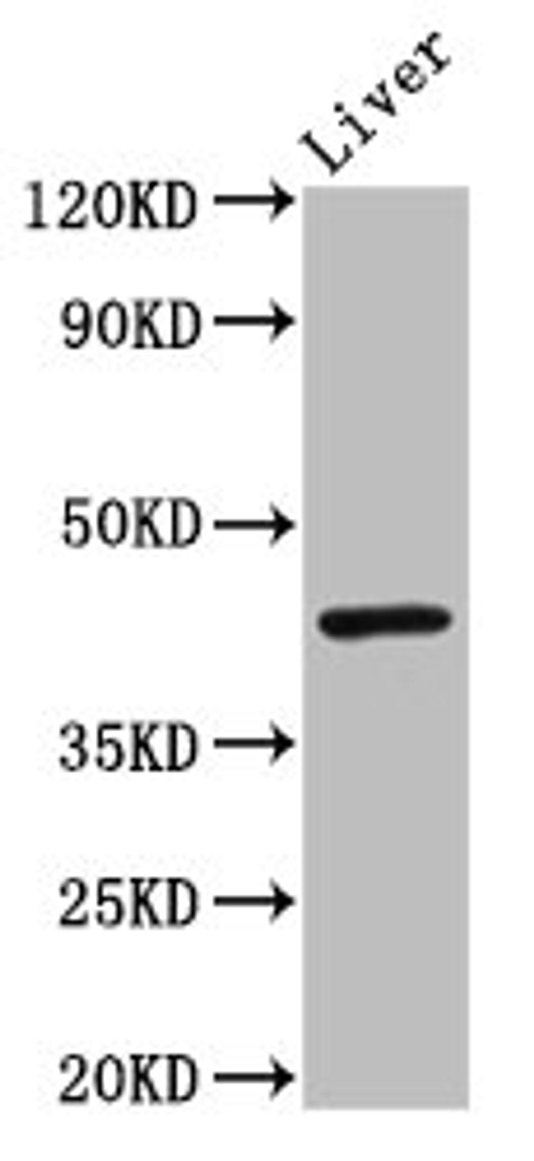 Western Blot. Positive WB detected in: Mouse liver tissue. All lanes: IRF9 antibody at 3ug/ml. Secondary. Goat polyclonal to rabbit IgG at 1/50000 dilution. Predicted band size: 44 kDa. Observed band size: 44 kDa.