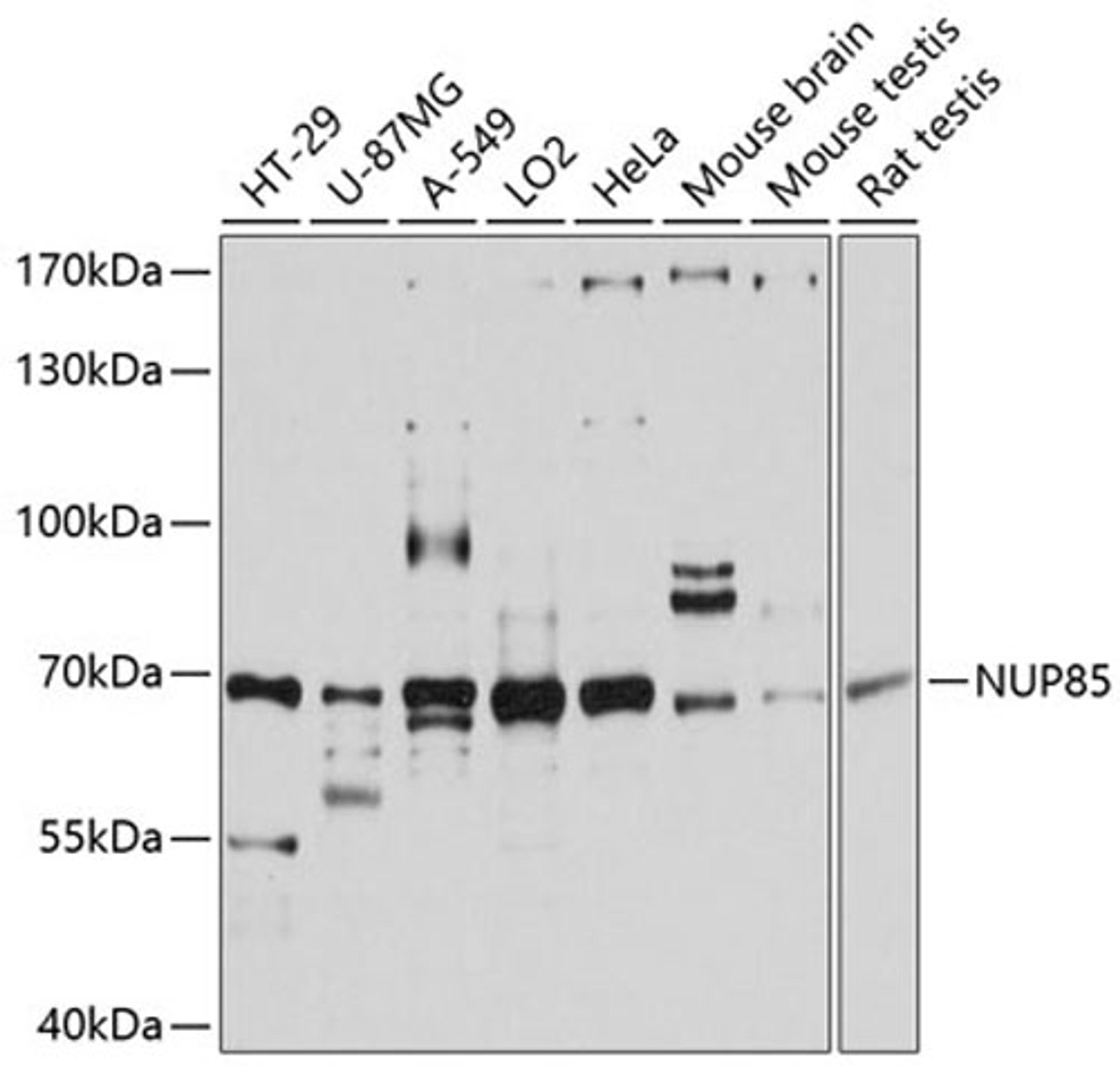 Western blot - NUP85 antibody (A11629)