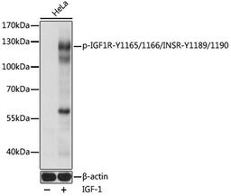 Western blot - Phospho-IGF1R-Y1165/1166/INSR-Y1189/1190 pAb (AP0902)