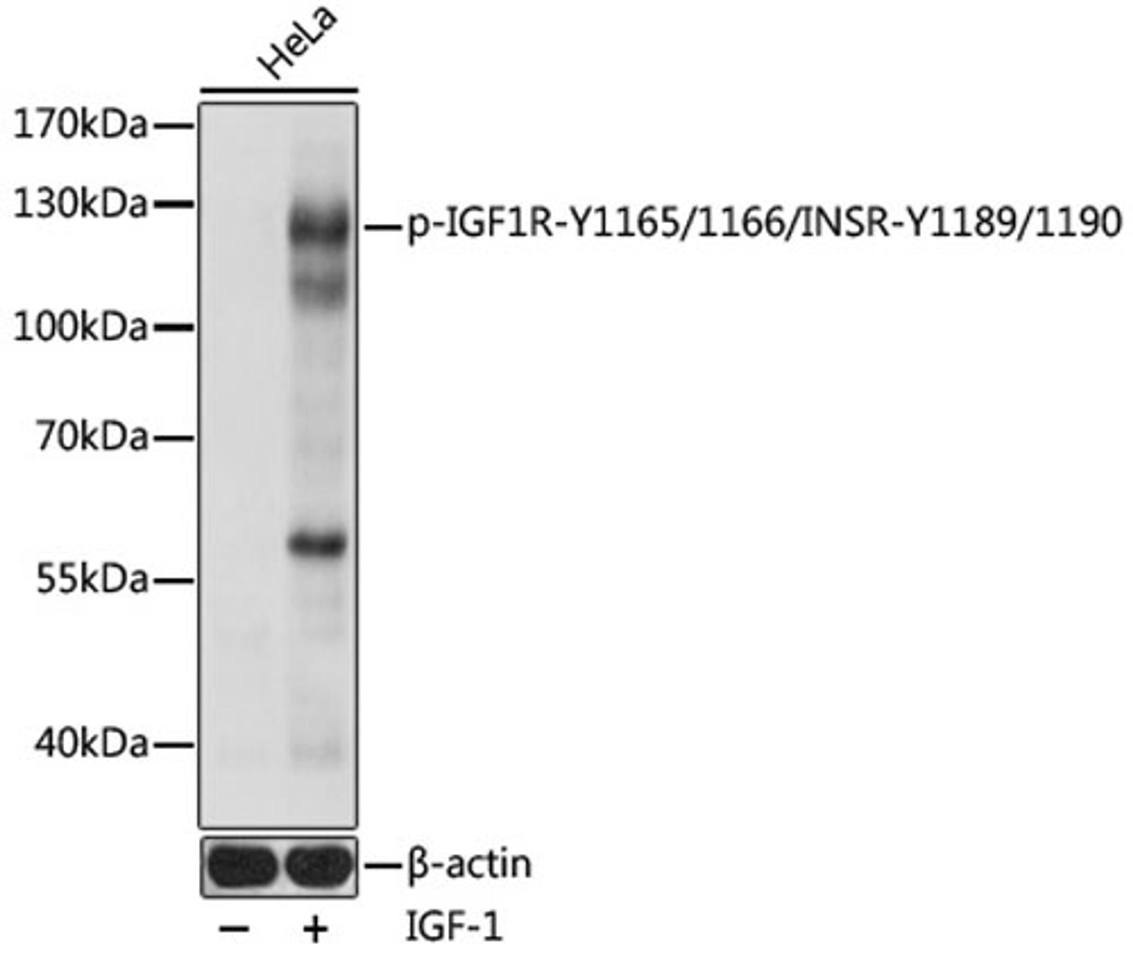 Western blot - Phospho-IGF1R-Y1165/1166/INSR-Y1189/1190 pAb (AP0902)