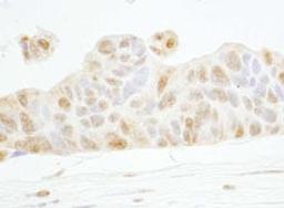 Detection of human Cyclin E1 by immunohistochemistry.