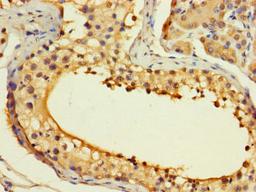 Immunohistochemistry of paraffin-embedded human testis tissue using CSB-PA878898LA01HU at dilution of 1:100