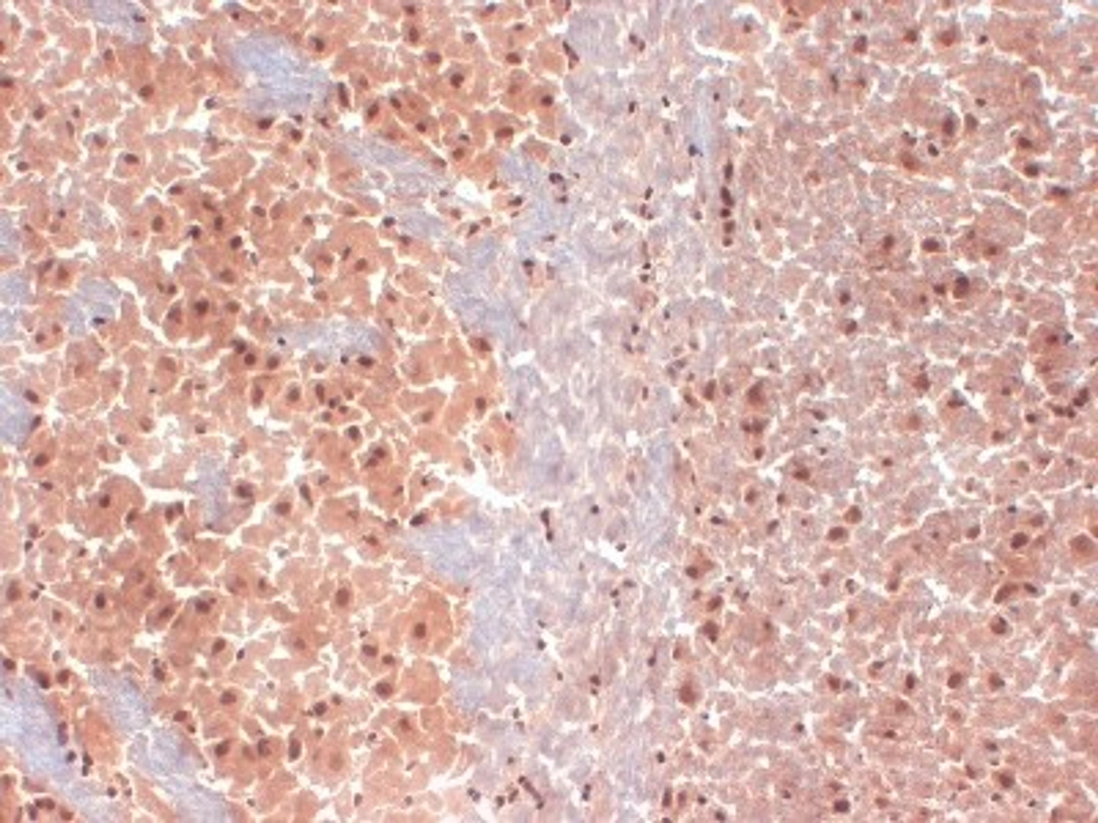 Immunohistochemistry-Frozen: HCN1 Antibody (S70-28) [NBP1-22450] - Frozen sections of mouse brain extract.