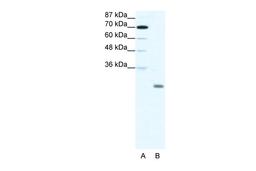 Antibody used in WB on Human HepG2 at 1.25 ug/ml.