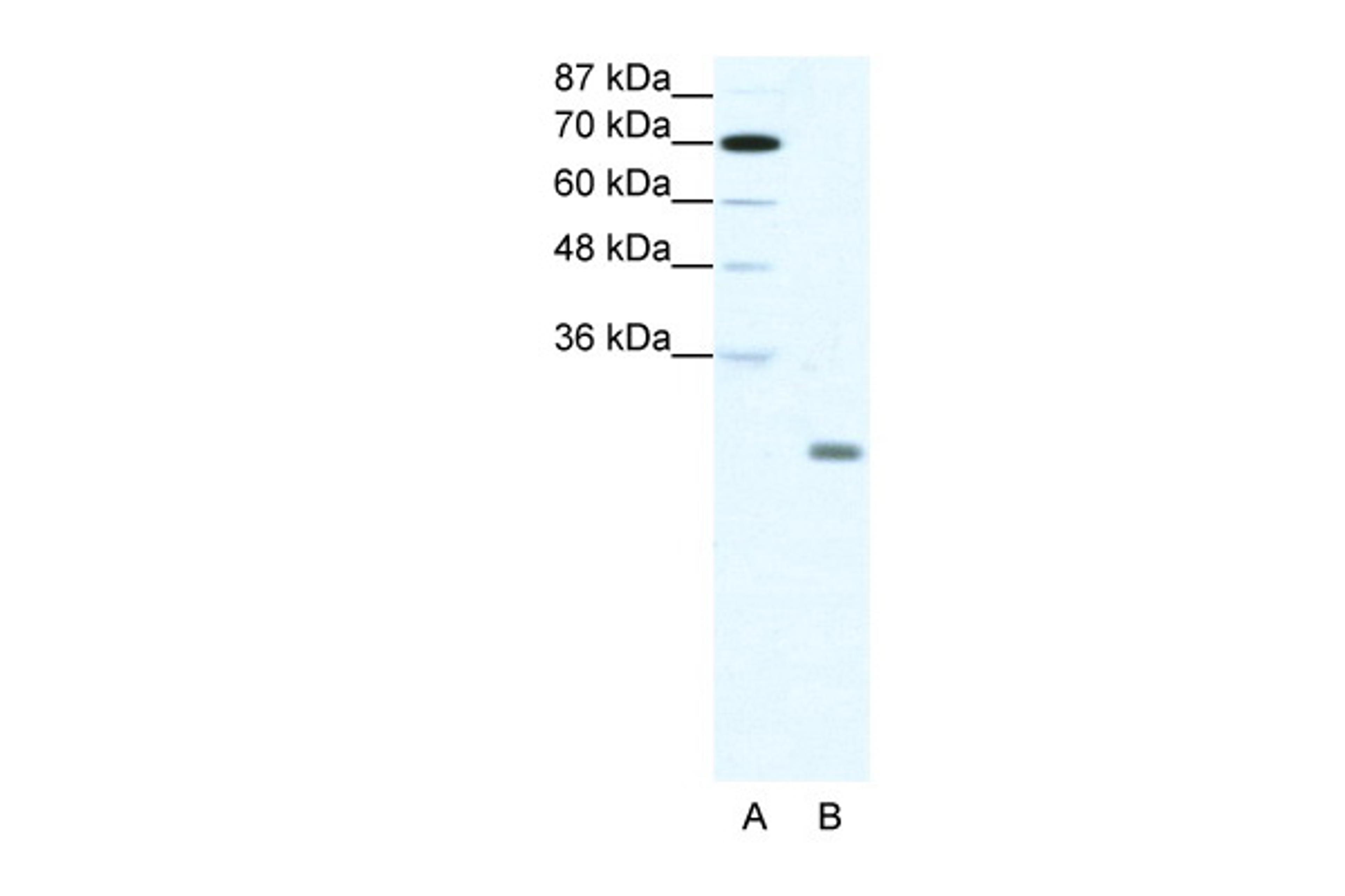 Antibody used in WB on Human HepG2 at 1.25 ug/ml.