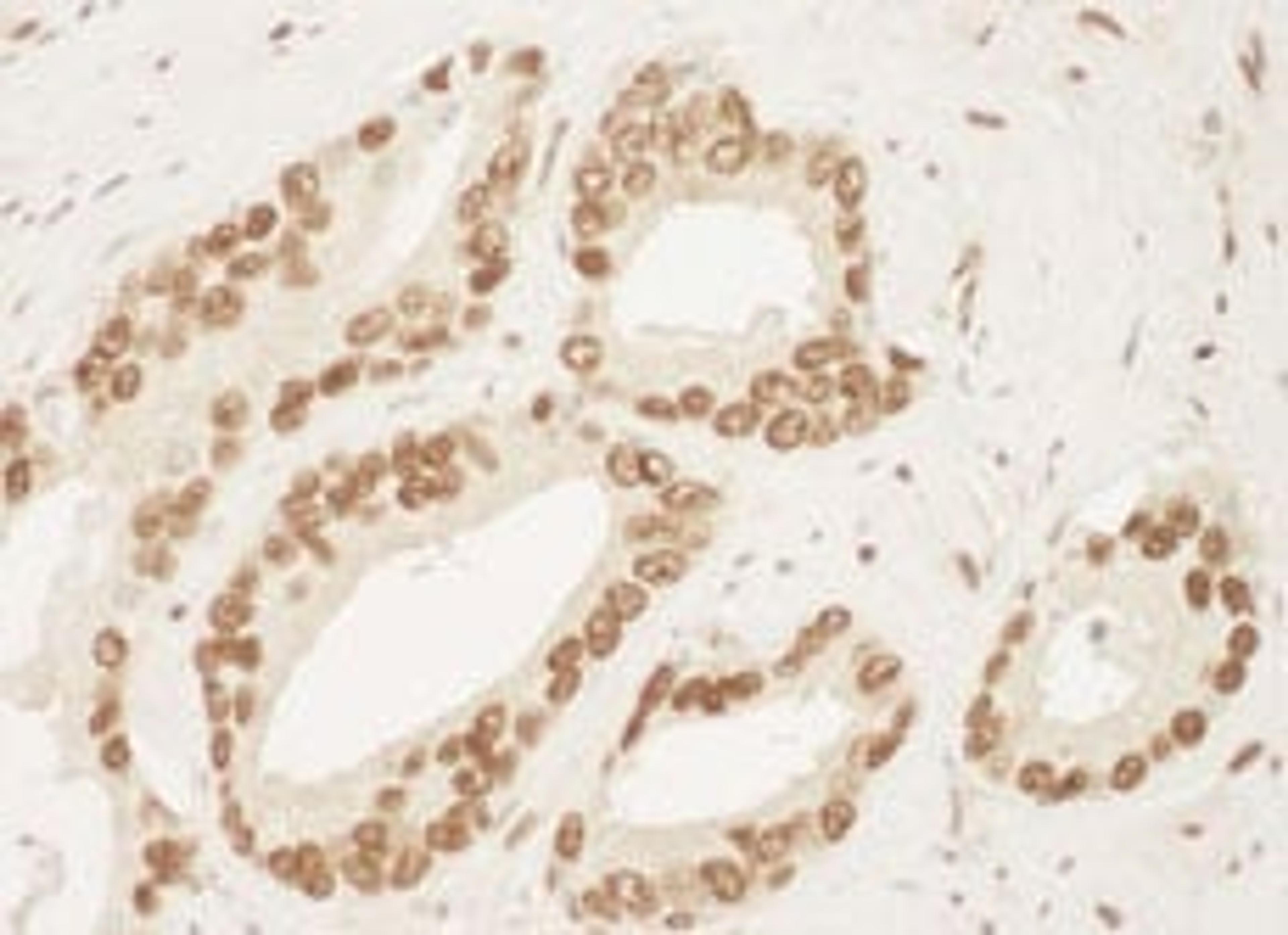 Detection of human Ku70 by immunohistochemistry.