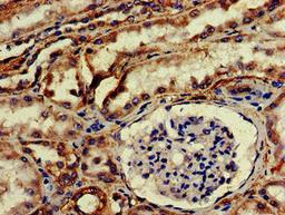 IHC image of CSB-PA010902EA01HU diluted at 1:200 and staining in paraffin-embedded human kidney tissue performed on a Leica BondTM system. After dewaxing and hydration, antigen retrieval was mediated by high pressure in a citrate buffer (pH 6.0). Section was blocked with 10% normal goat serum 30min at RT. Then primary antibody (1% BSA) was incubated at 4&deg;C overnight. The primary is detected by a biotinylated secondary antibody and visualized using an HRP conjugated SP system.