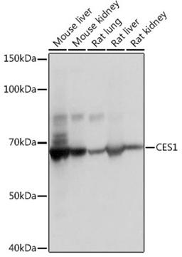 Western blot - CES1 Rabbit mAb (A11478)