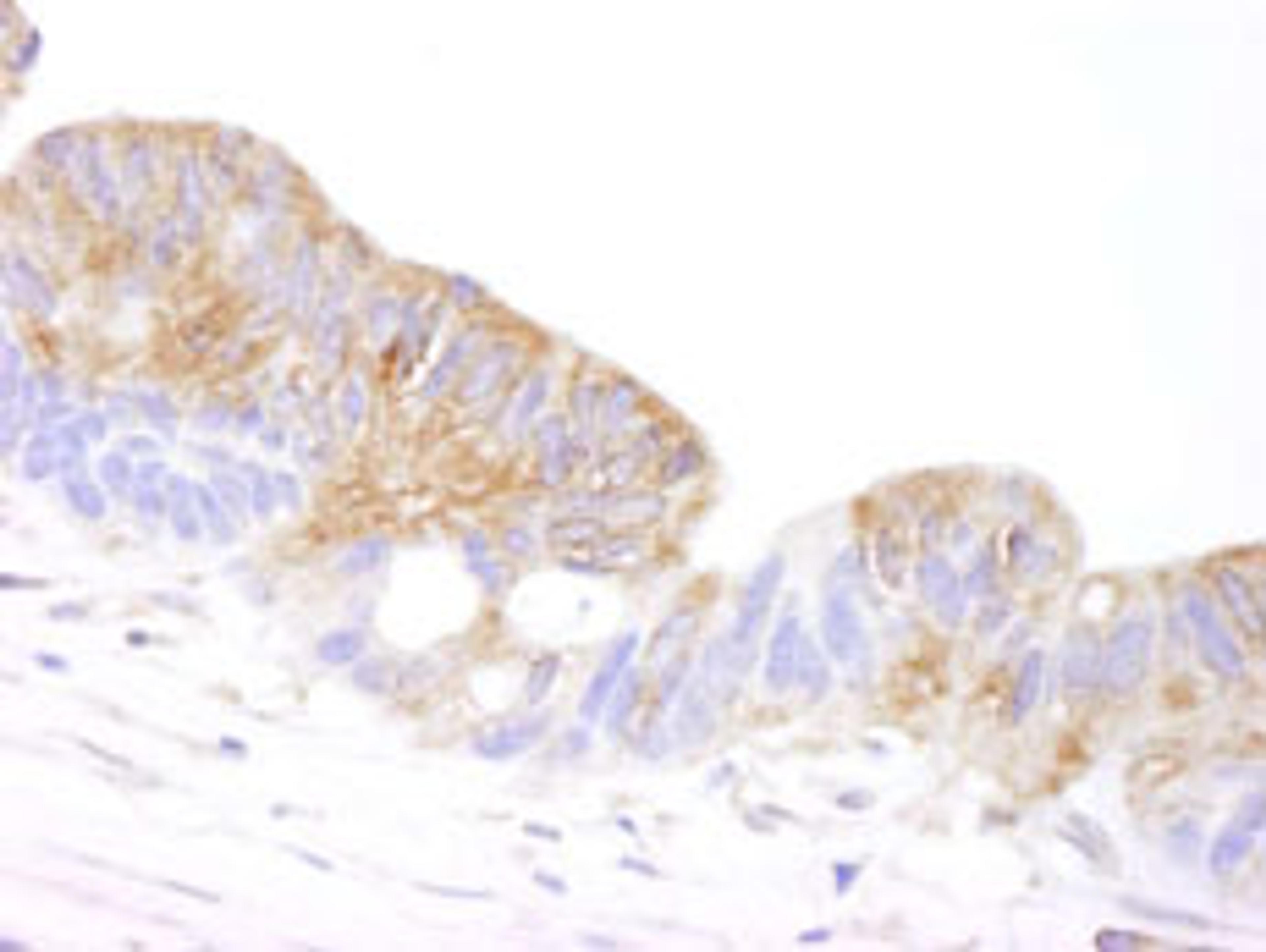 Detection of human Coronin 2 by immunohistochemistry.