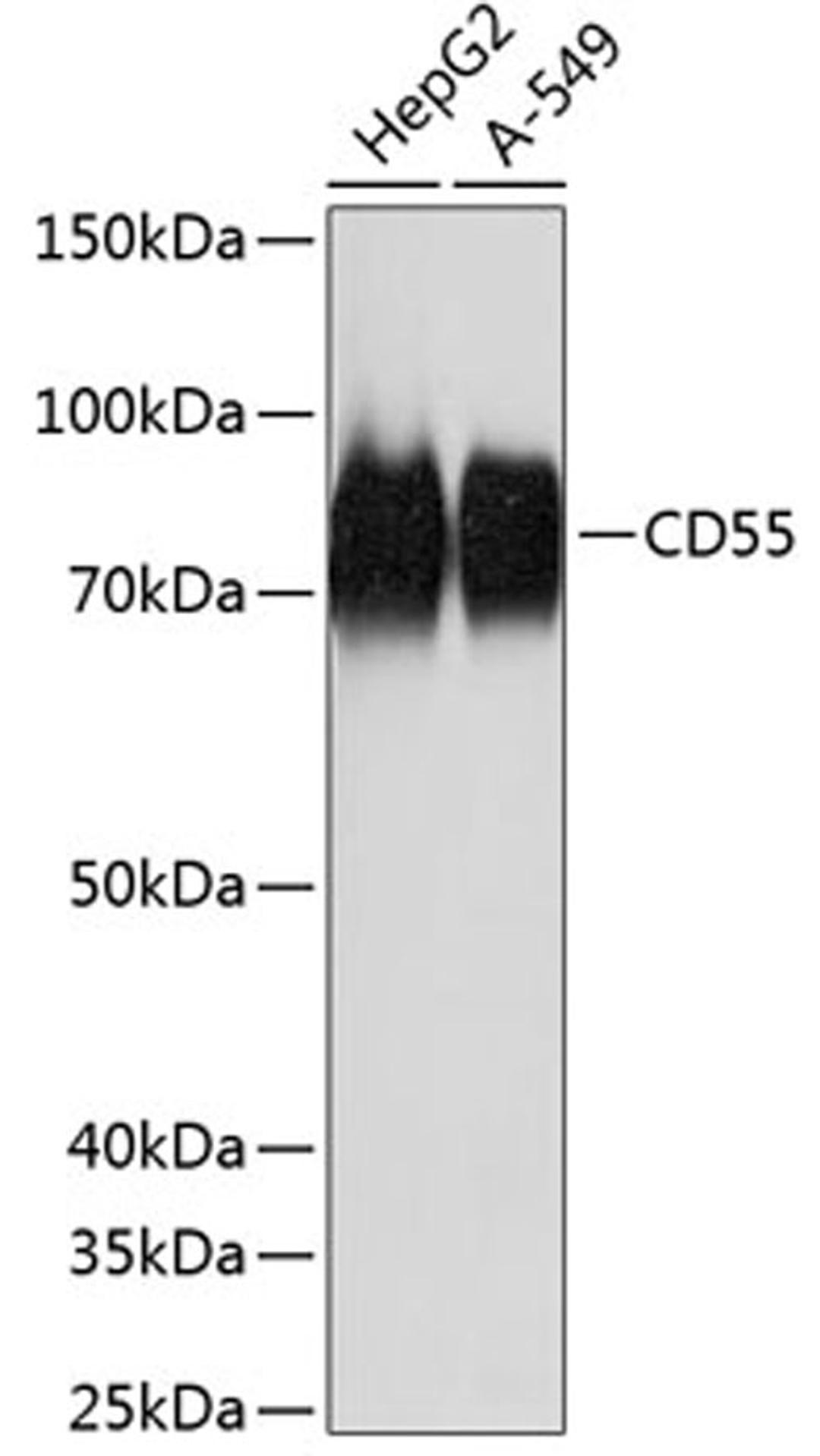 Western blot - CD55 Rabbit mAb (A11283)