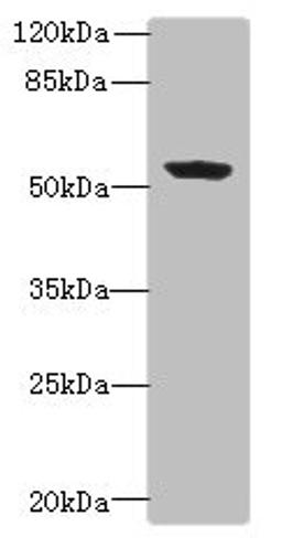 Western blot. All lanes: PLEKHA8 antibody at 0.8ug/ml + Mouse brain tissue. Secondary. Goat polyclonal to rabbit IgG at 1/10000 dilution. Predicted band size: 59, 52, 50 kDa. Observed band size: 59 kDa. 