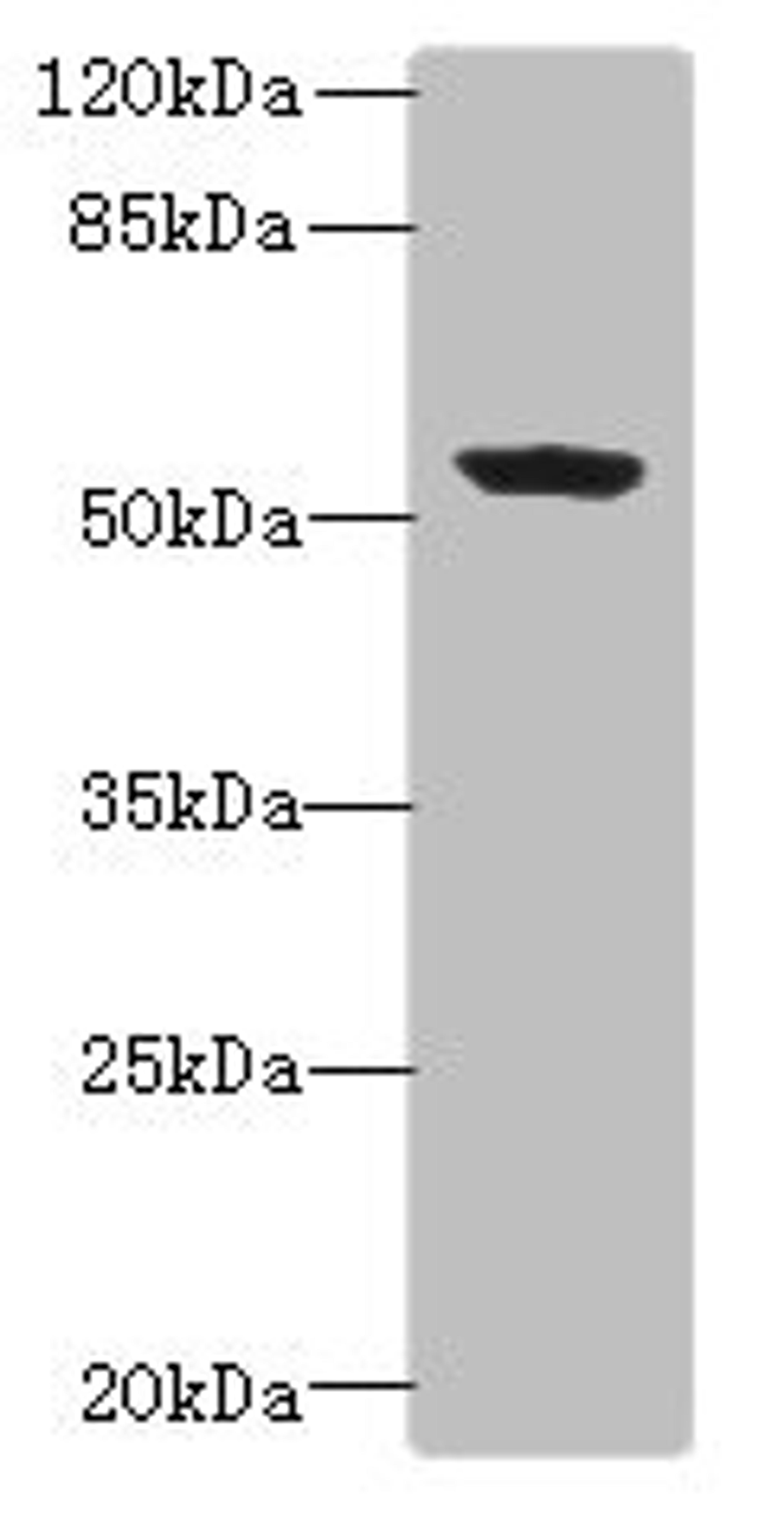 Western blot. All lanes: PLEKHA8 antibody at 0.8ug/ml + Mouse brain tissue. Secondary. Goat polyclonal to rabbit IgG at 1/10000 dilution. Predicted band size: 59, 52, 50 kDa. Observed band size: 59 kDa. 