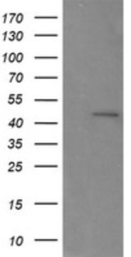 Western Blot: RNF39 Antibody (5E10) [NBP2-45962] - Analysis of HEK293T cells were transfected with the pCMV6-ENTRY control (Left lane) or pCMV6-ENTRY RNF39.