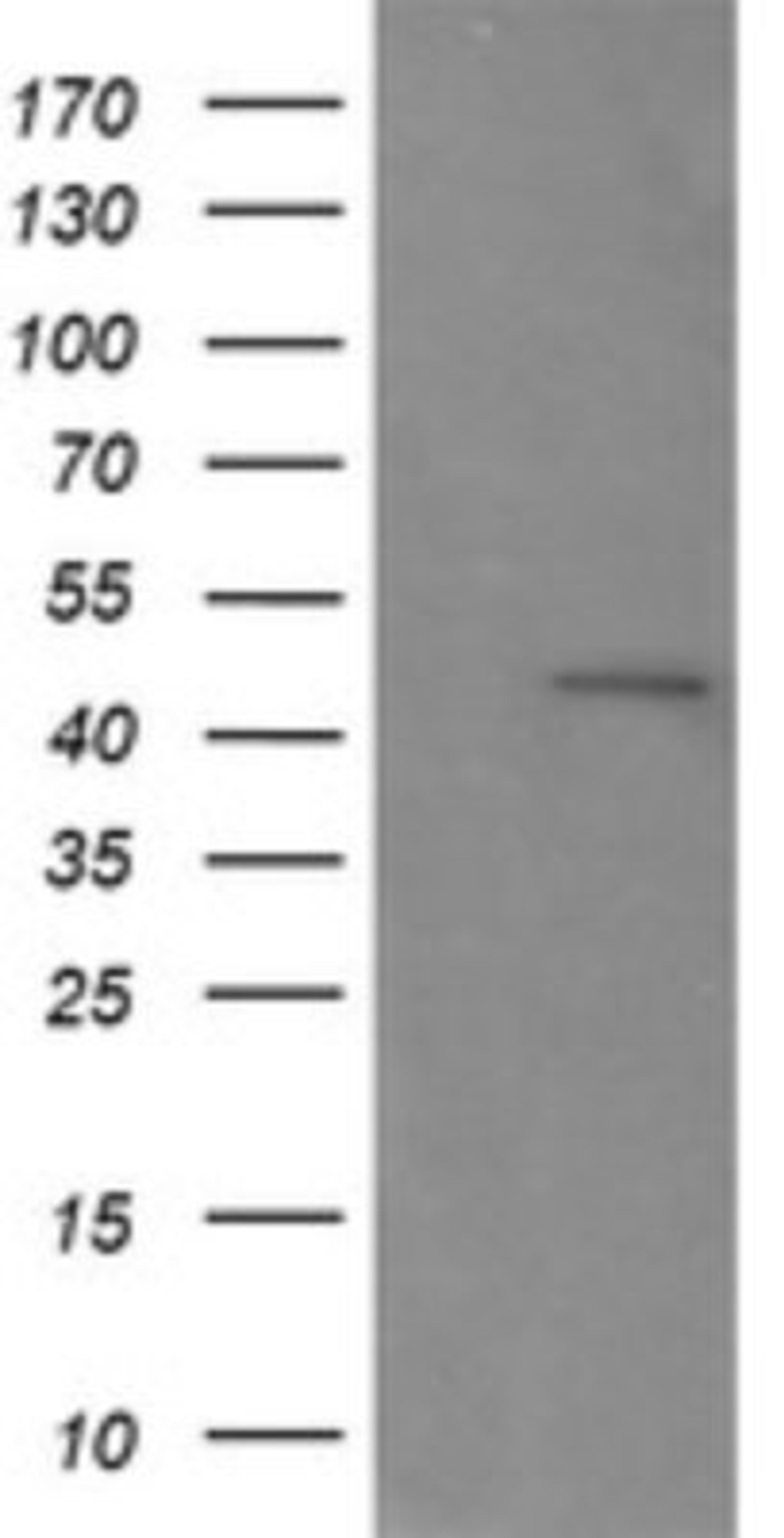 Western Blot: RNF39 Antibody (5E10) [NBP2-45962] - Analysis of HEK293T cells were transfected with the pCMV6-ENTRY control (Left lane) or pCMV6-ENTRY RNF39.