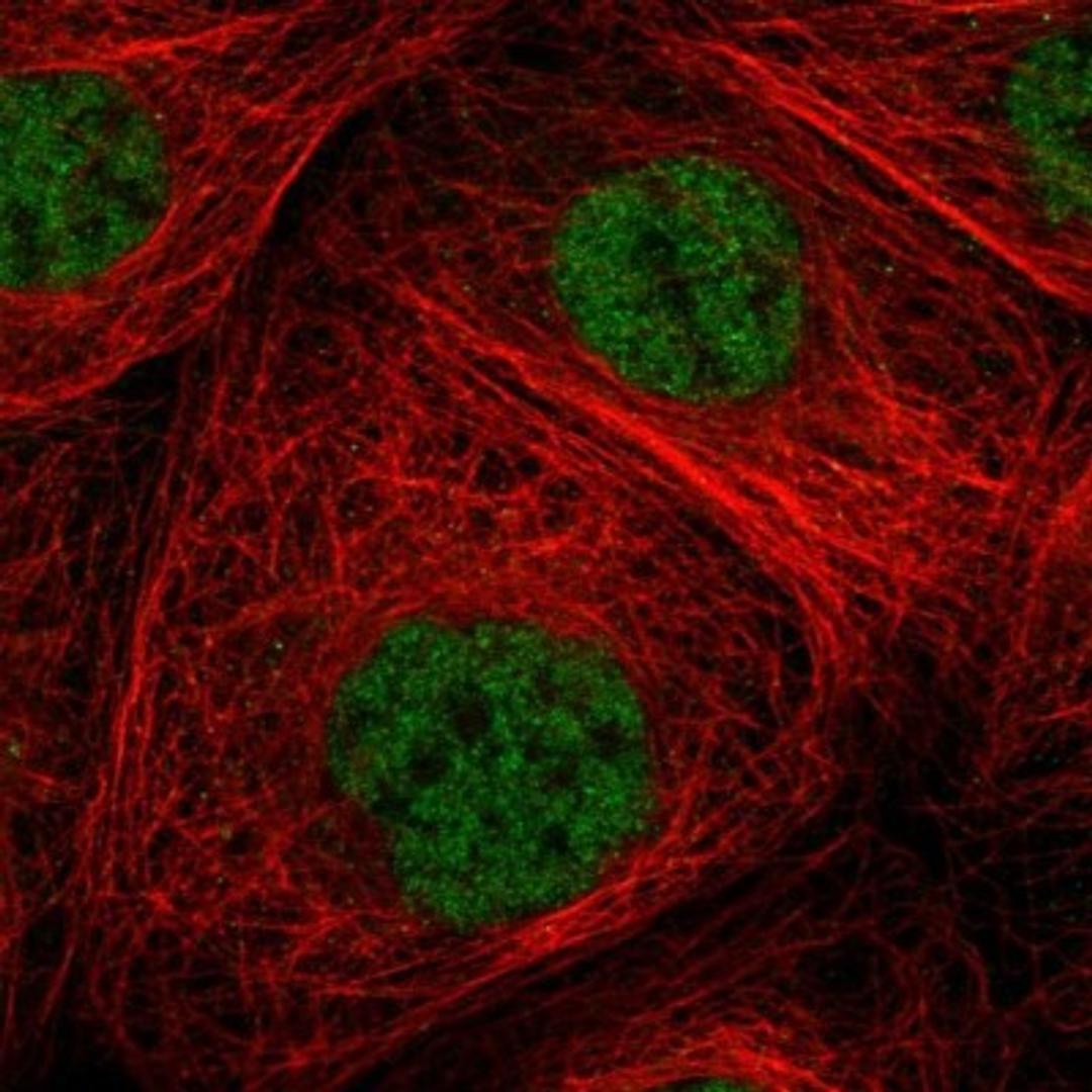 Immunocytochemistry/Immunofluorescence: ZNF354B Antibody [NBP1-82064] - Staining of human cell line A-431 shows positivity in nucleus but not nucleoli.