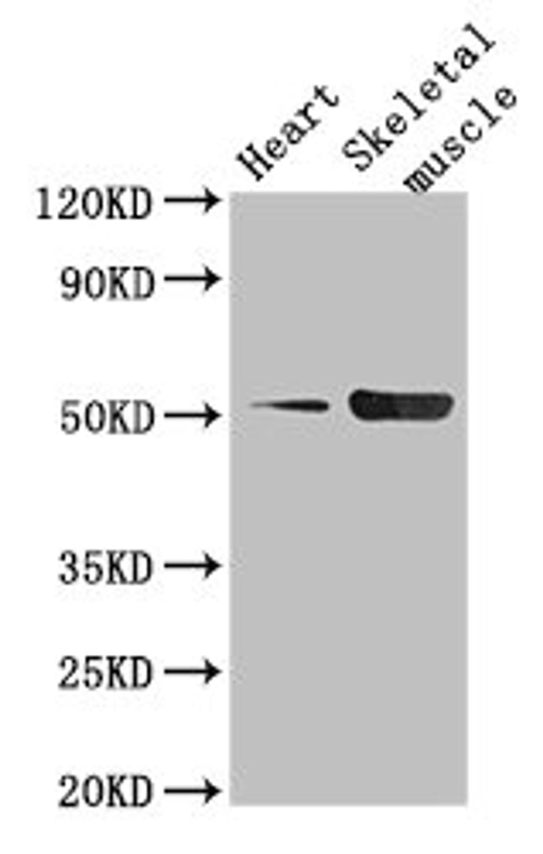 Western Blot. Positive WB detected in: Mouse heart tissue, Mouse skeletal muscle tissue. All lanes: TPH1 antibody at 2.5µg/ml. Secondary. Goat polyclonal to rabbit IgG at 1/50000 dilution. Predicted band size: 51, 54 kDa. Observed band size: 51 kDa