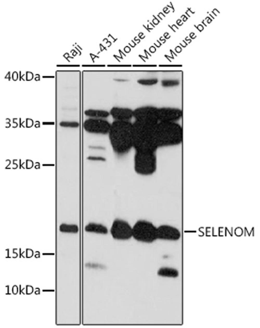 Western blot - SELENOM antibody (A16660)