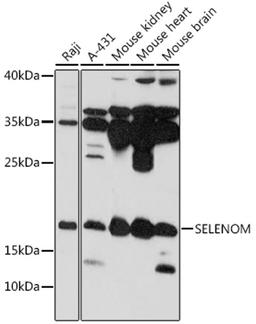 Western blot - SELENOM antibody (A16660)