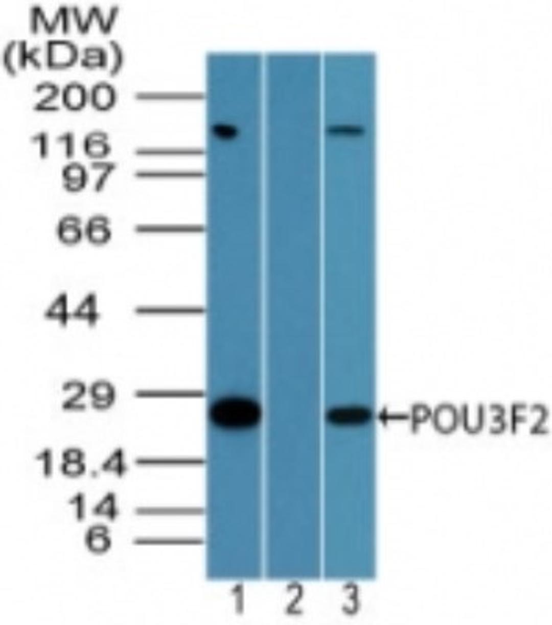 Western Blot: OCT7 Antibody [NBP2-24658] - analysis of POU3F2 in human Jurkat cell lysate in the 1) absence, 2) presence of immunizing peptide and 3) mouse NIH 3T3 cell lysate in absence of immunizing peptide using this antibody. I goat anti-rabbit Ig HRP secondary antibody and PicoTect ECL substrate solution were used for this test.