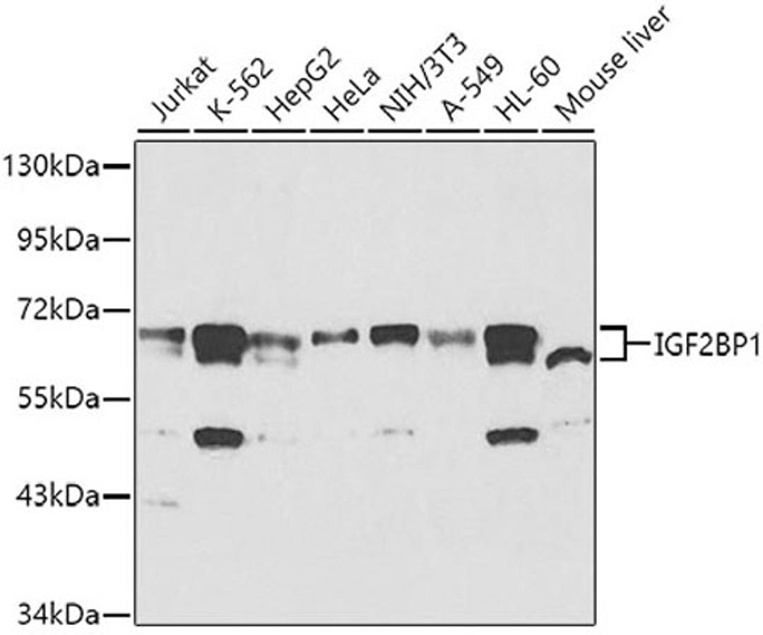 Western blot - IGF2BP1 antibody (A13581)