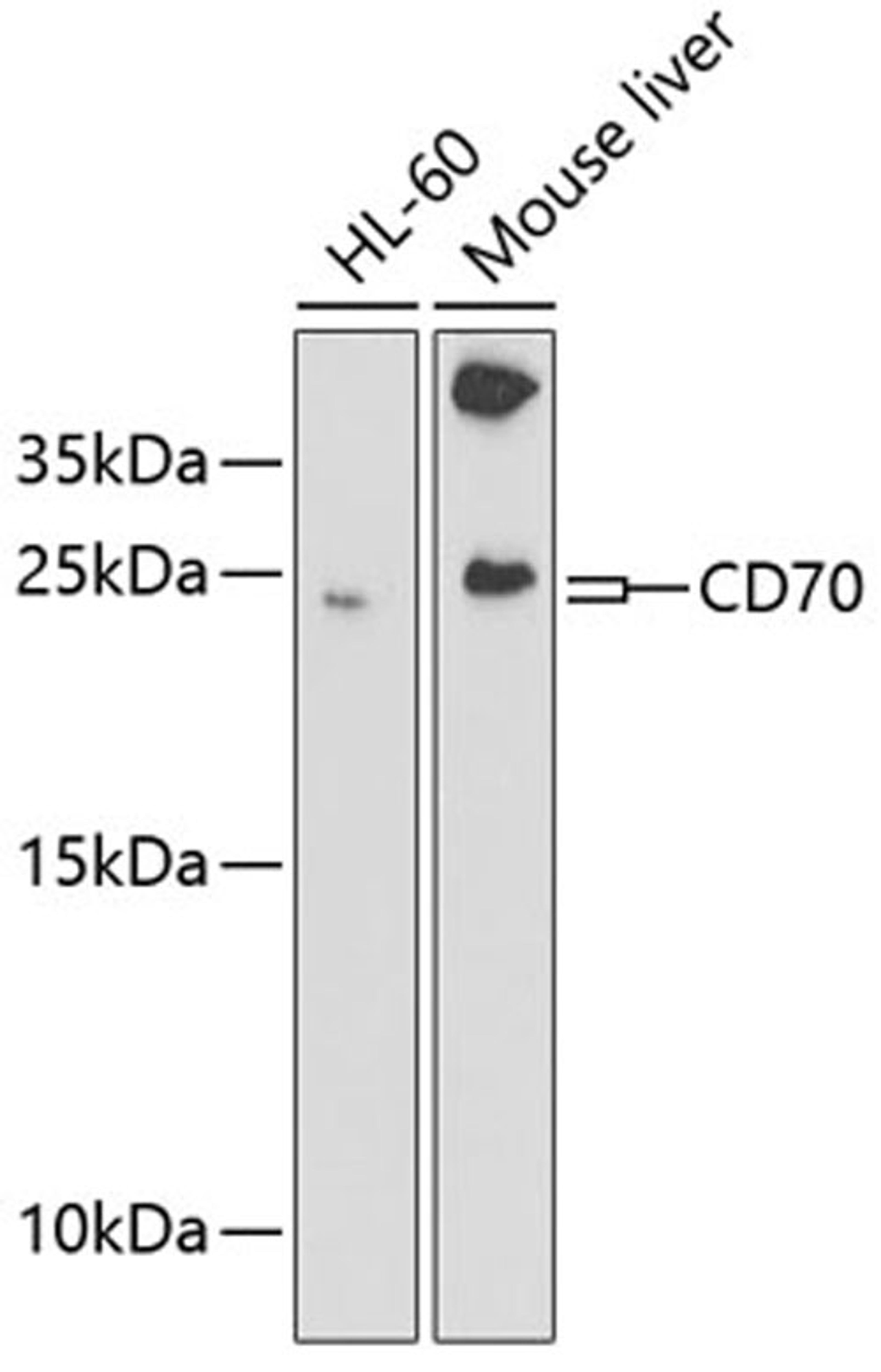 Western blot - CD70 antibody (A2032)