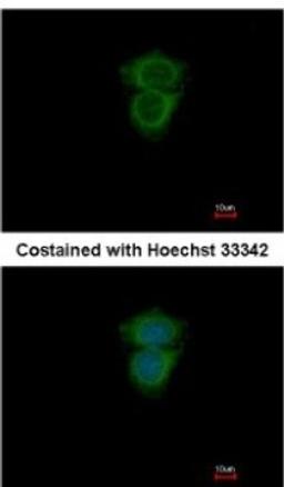 Immunocytochemistry/Immunofluorescence: RAB11B Antibody [NBP2-15085] - Analysis of methanol-fixed MCF-7, using antibody at 1:200 dilution.