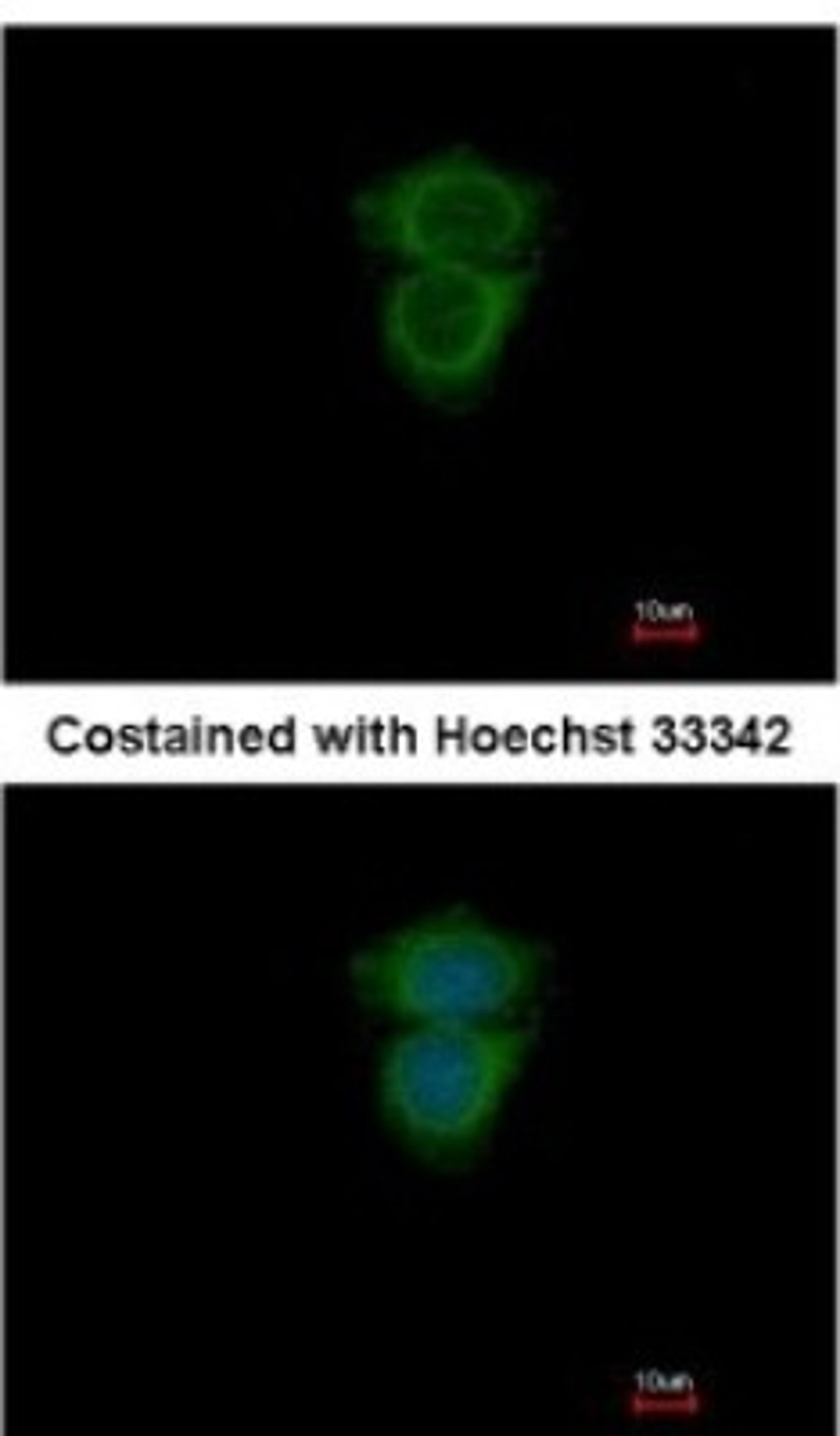 Immunocytochemistry/Immunofluorescence: RAB11B Antibody [NBP2-15085] - Analysis of methanol-fixed MCF-7, using antibody at 1:200 dilution.