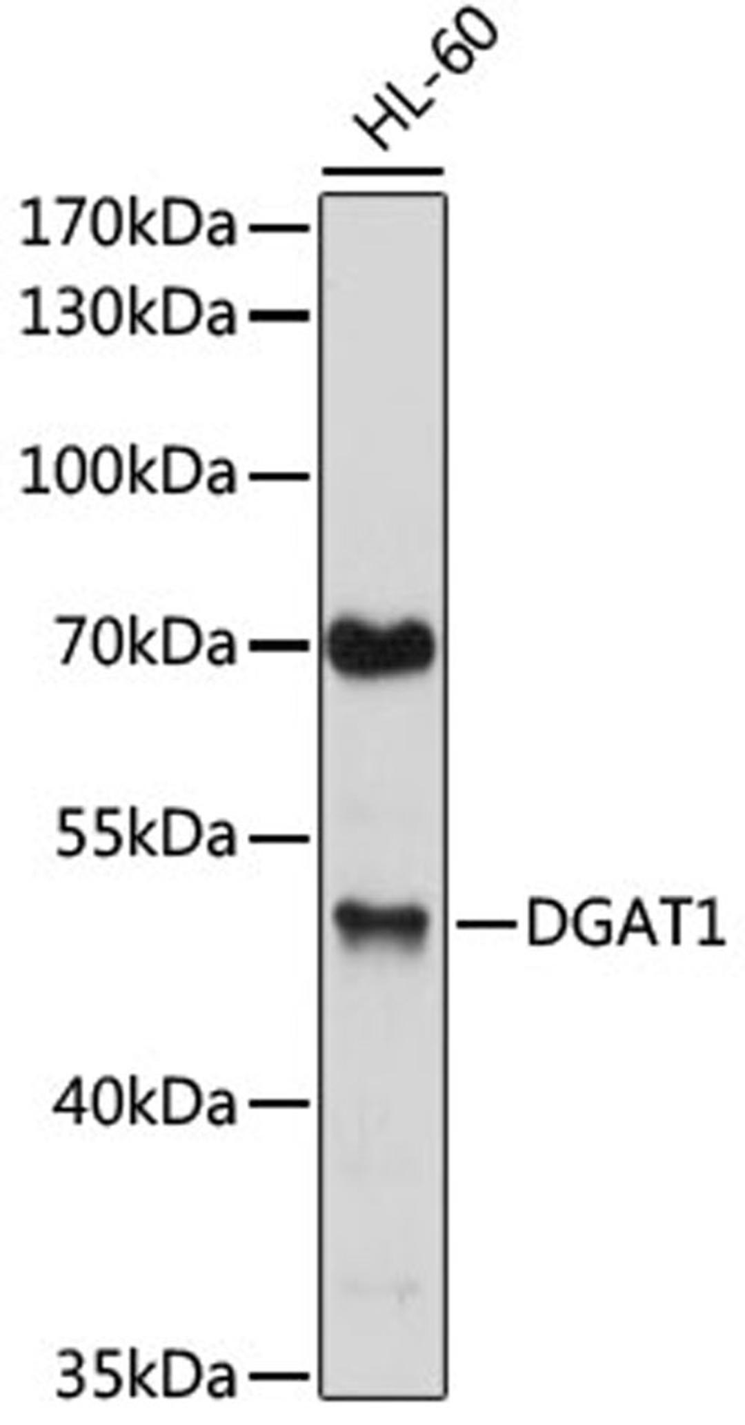 Western blot - DGAT1 antibody (A6857)