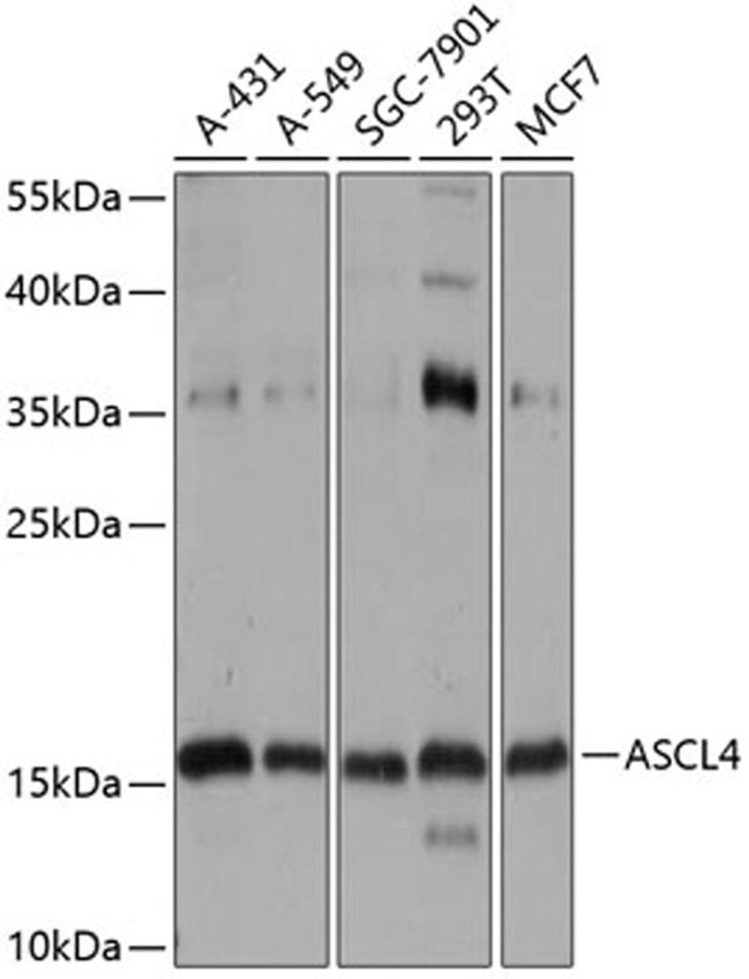 Western blot - ASCL4 antibody (A14439)