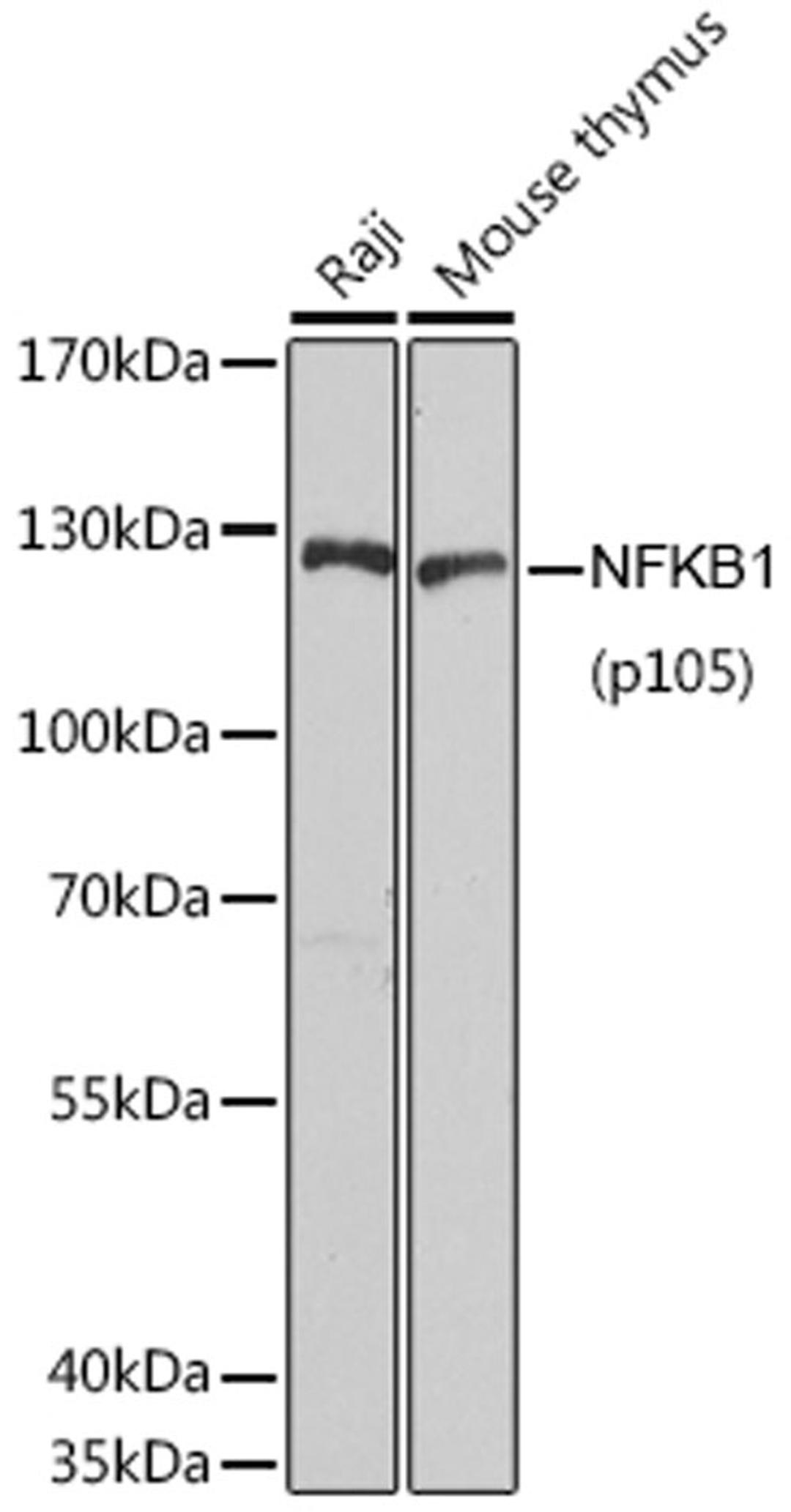 Western blot - NFKB1 antibody (A6667)