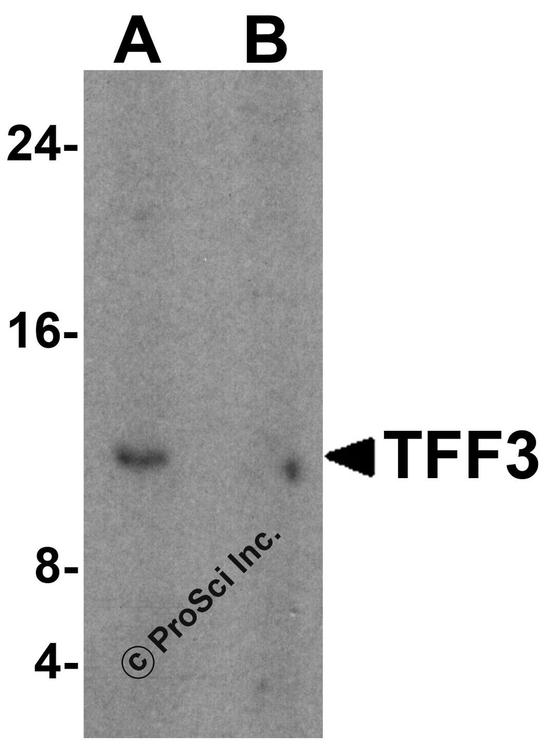 Western blot analysis of TFF3 in human colon tissue lysate with TFF3 antibody at 1 μg/mL in (A) the absence and (B) the presence of blocking peptide.