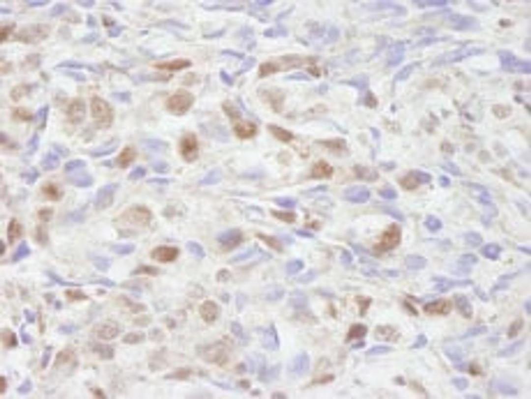 Detection of human NCOA2/SRC2 by immunohistochemistry.