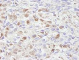 Detection of human NCOA2/SRC2 by immunohistochemistry.