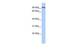 Antibody used in WB on Human HepG2 at 0.2-1 ug/ml.