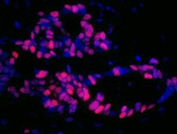 Detection of human p53 by immunofluorescence.