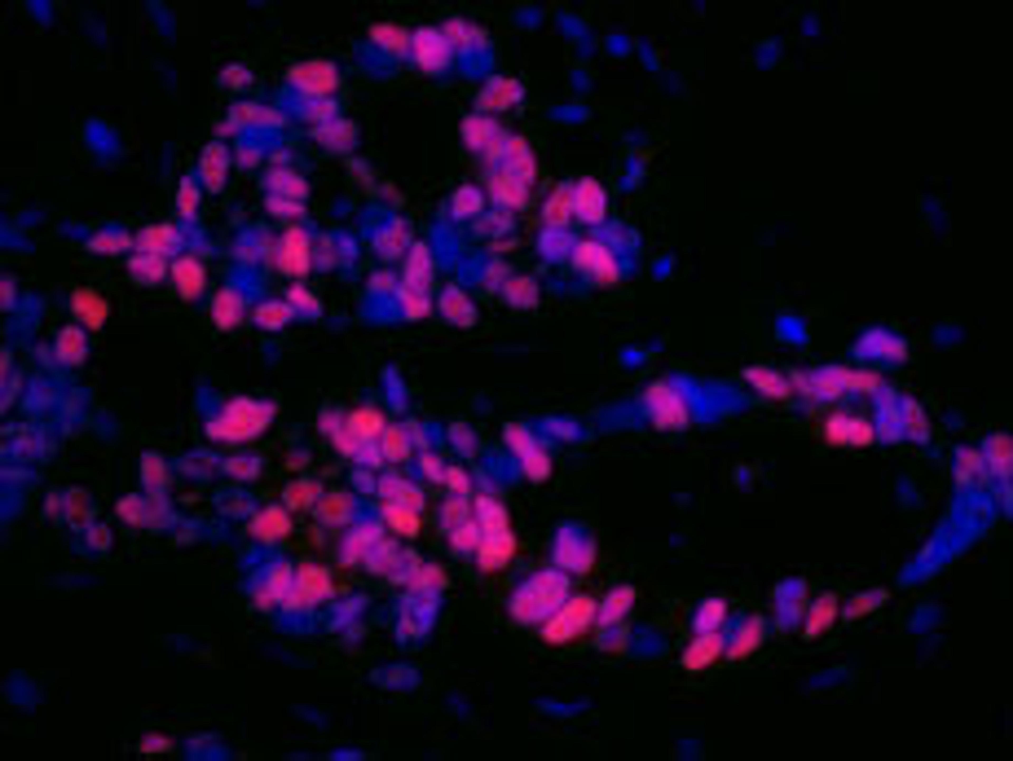 Detection of human p53 by immunofluorescence.