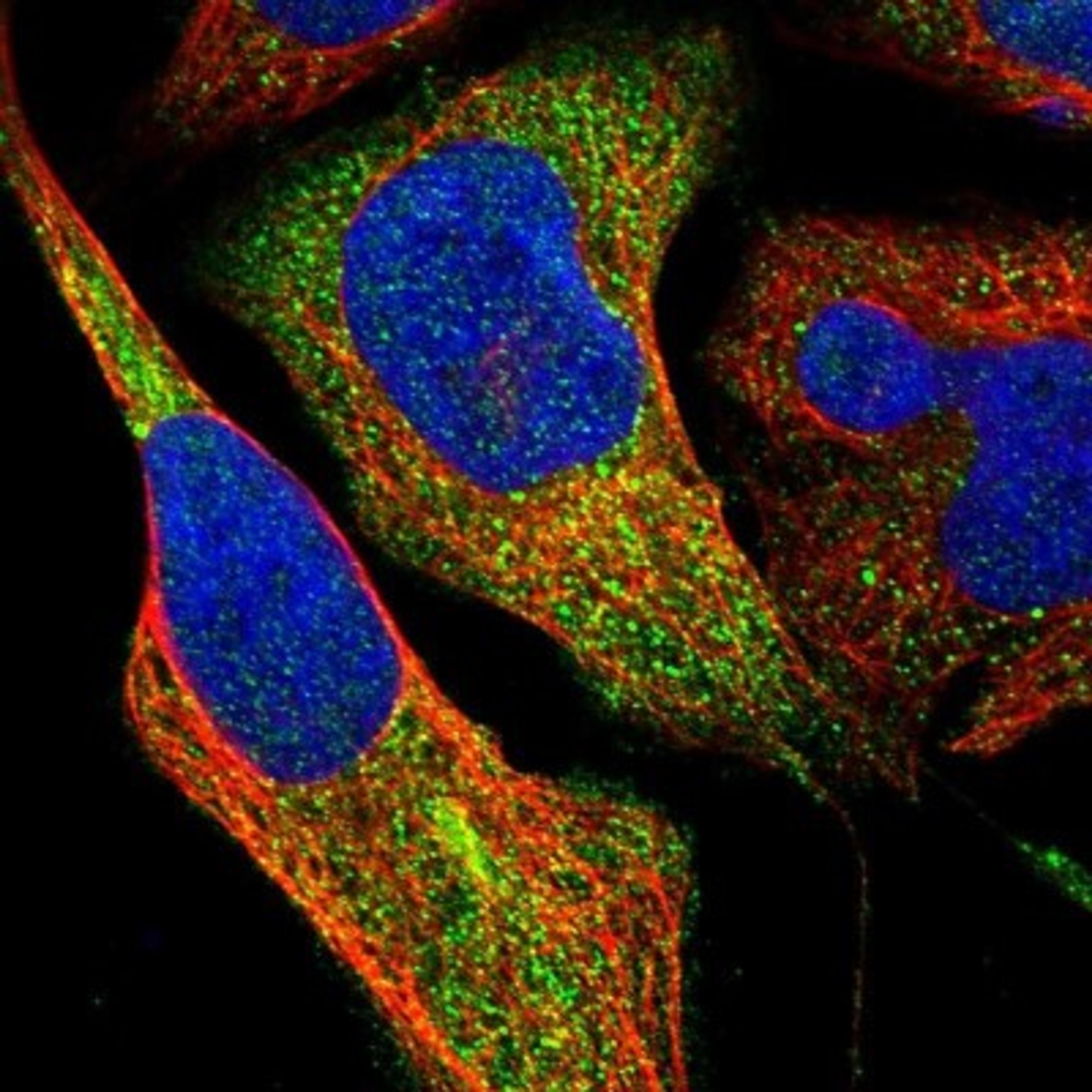 Immunocytochemistry/Immunofluorescence: ZNF70 Antibody [NBP1-84402] - Staining of human cell line U-2 OS shows positivity in cytoplasm.