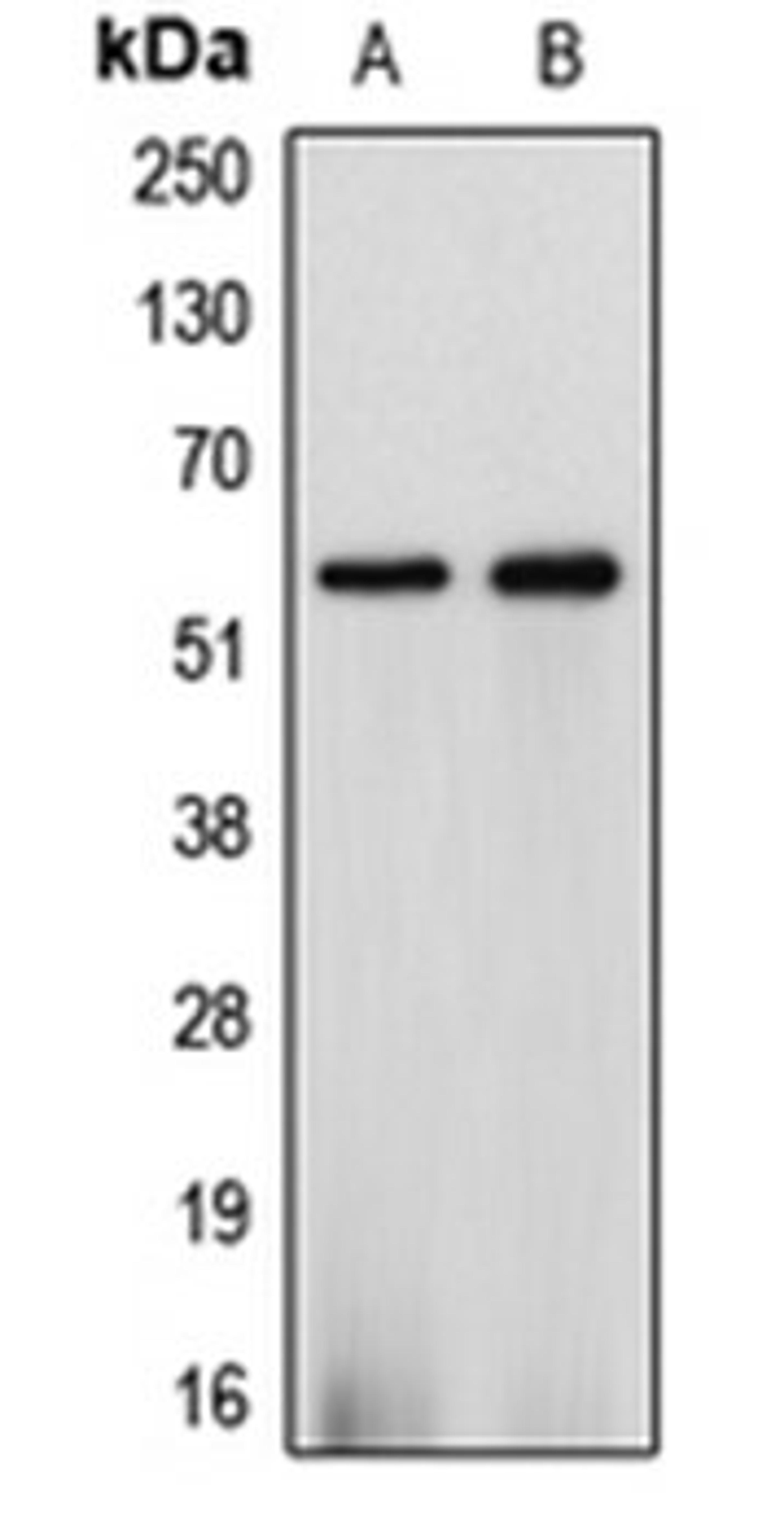 Western blot analysis of HepG2 (Lane 1), A549 (Lane 2) whole cell lysates using CYP2J2 antibody