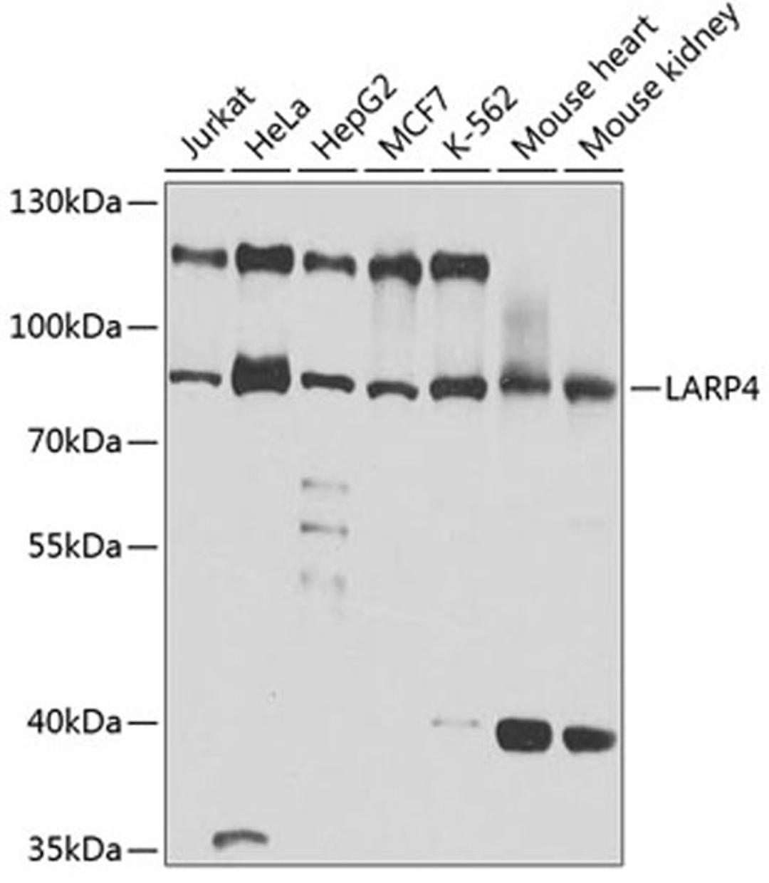 Western blot - LARP4 antibody (A5108)