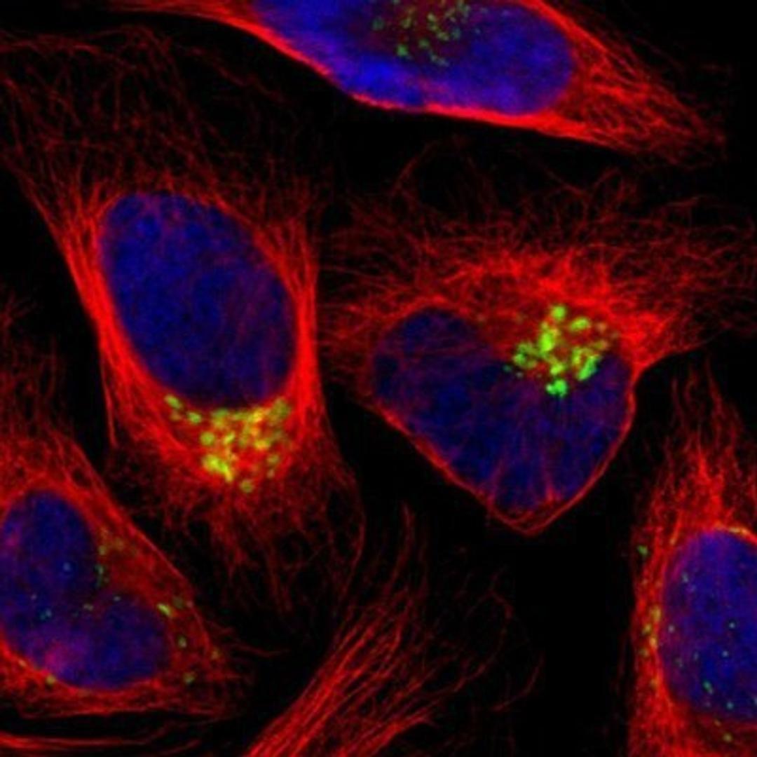 Immunocytochemistry/Immunofluorescence: GALNT2 Antibody [NBP1-83394] - Staining of human cell line U-2 OS shows positivity in golgi.