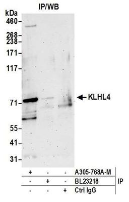 Detection of Human KLHL4 by WB of IP.