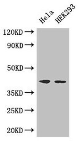 Western Blot. Positive WB detected in: Hela whole cell lysate, HEK293 whole cell lysate. All lanes: ACTG1 antibody at 3ug/ml. Secondary. Goat polyclonal to rabbit IgG at 1/50000 dilution. Predicted band size: 42 kDa. Observed band size: 42 kDa. 